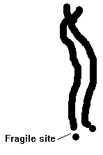 drawing of  fragile X site